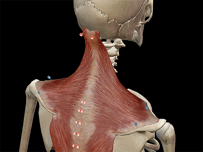 Learn Muscle Anatomy Trapezius