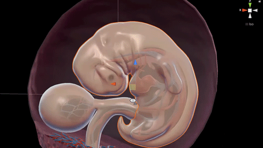 in-progress-4-6-week-embryo