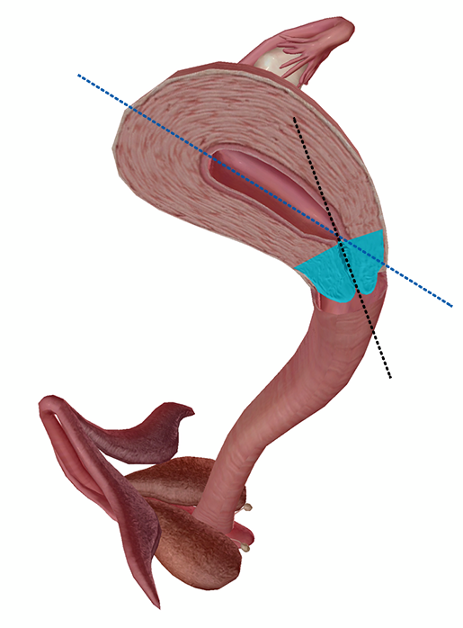 Anatomy And Physiology 4 Facts About The Cervix 4504