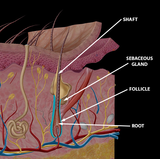 ingrown hair on shaft