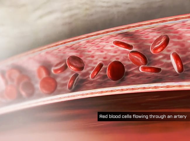 Anatomy and Physiology: The Pitfalls of LDL Cholesterol