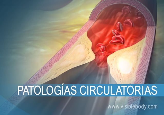 01B-Patologías-circulatorias