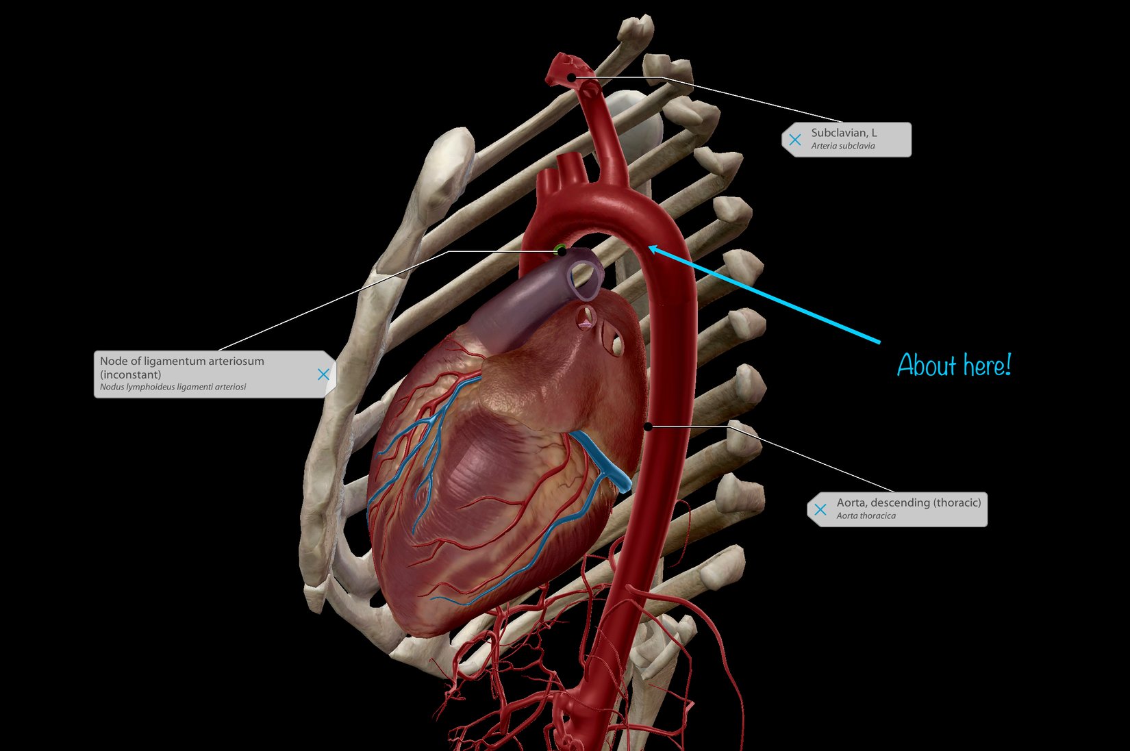 Аорта человека фото. Thoracic Aorta. Аорта у лошадей. Руптура торакальной аорты. Грудная аорта лошади.