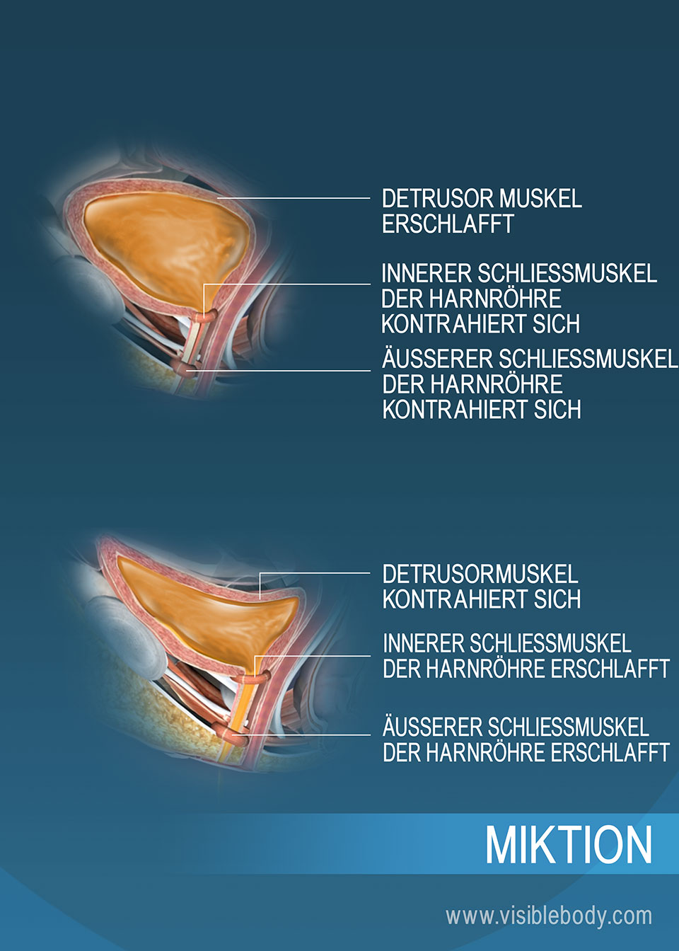 Eine Harnblase mit gesammeltem Urin und eine Harnblase im Zustand der Entleerung – jeweils mit den Harnröhrenschließmuskeln und dem Detrusormuskel, die den Vorgang erleichtern