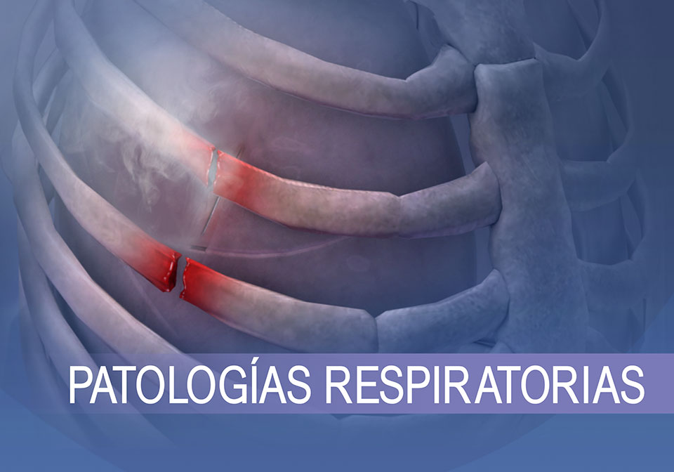 Los problemas respiratorios comunes varían entre un colapso pulmonar (imagen) y la bronquitis, asma y otros